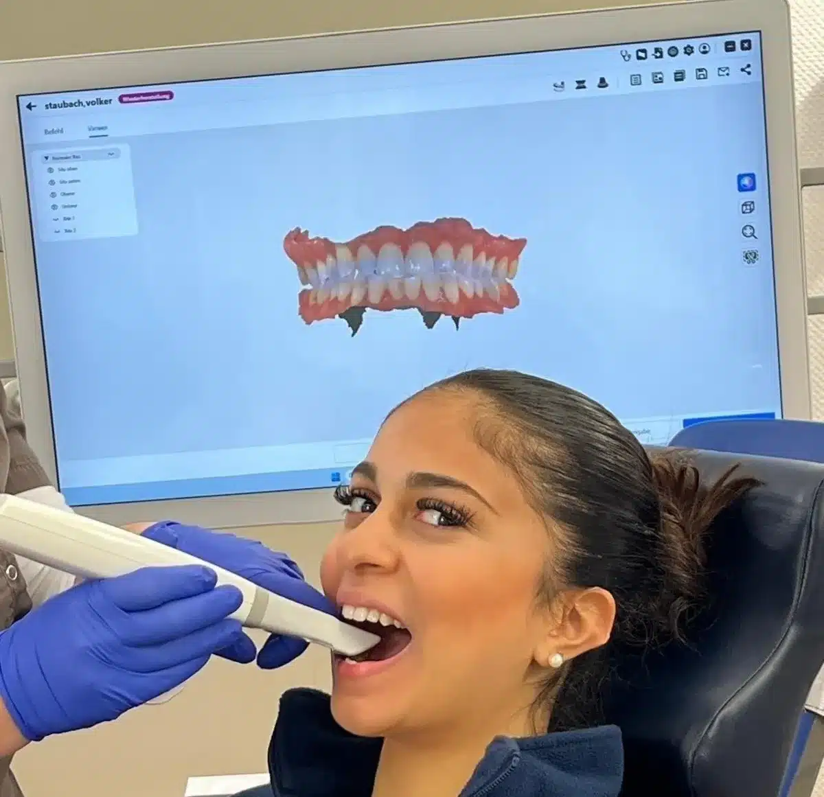 Beitrag Intraoralscanner